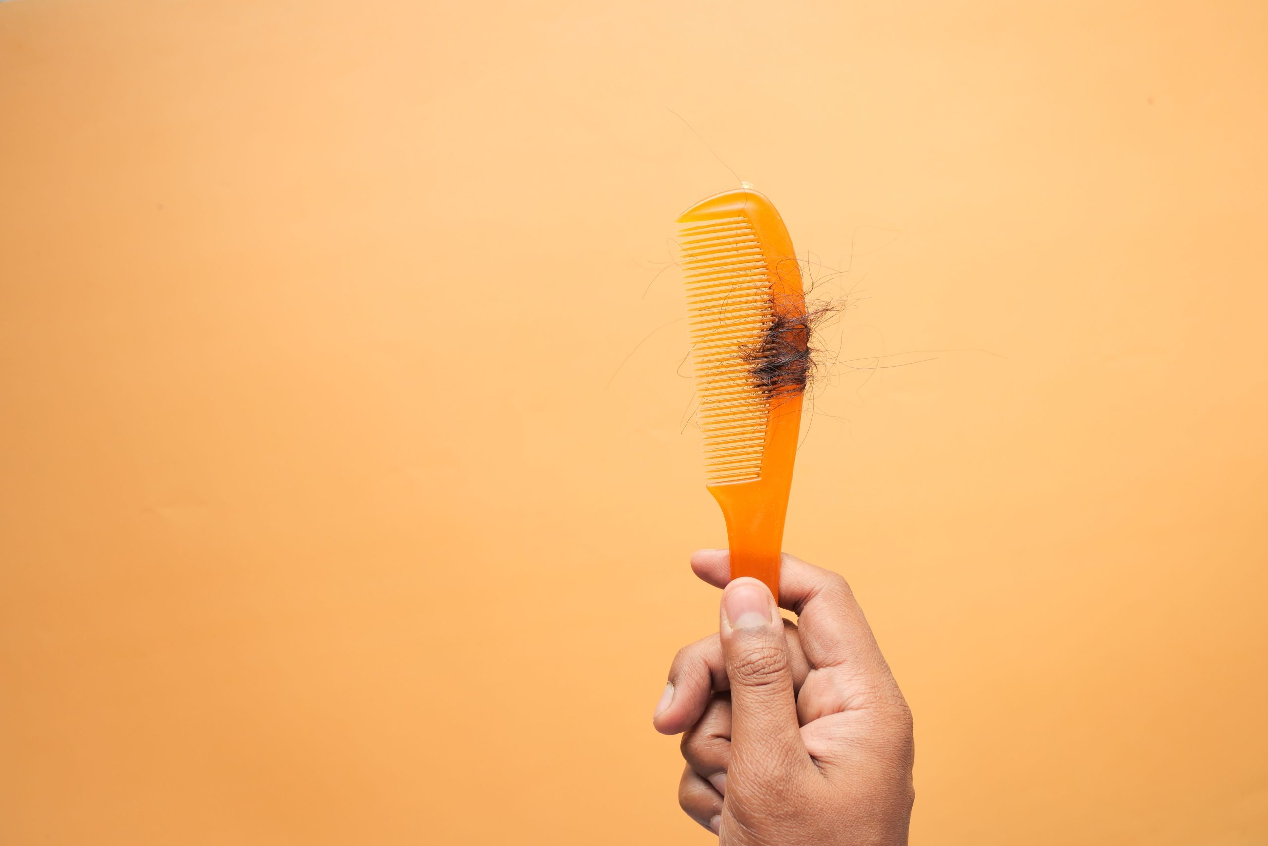Début de calvitie arrêter chute cheveux