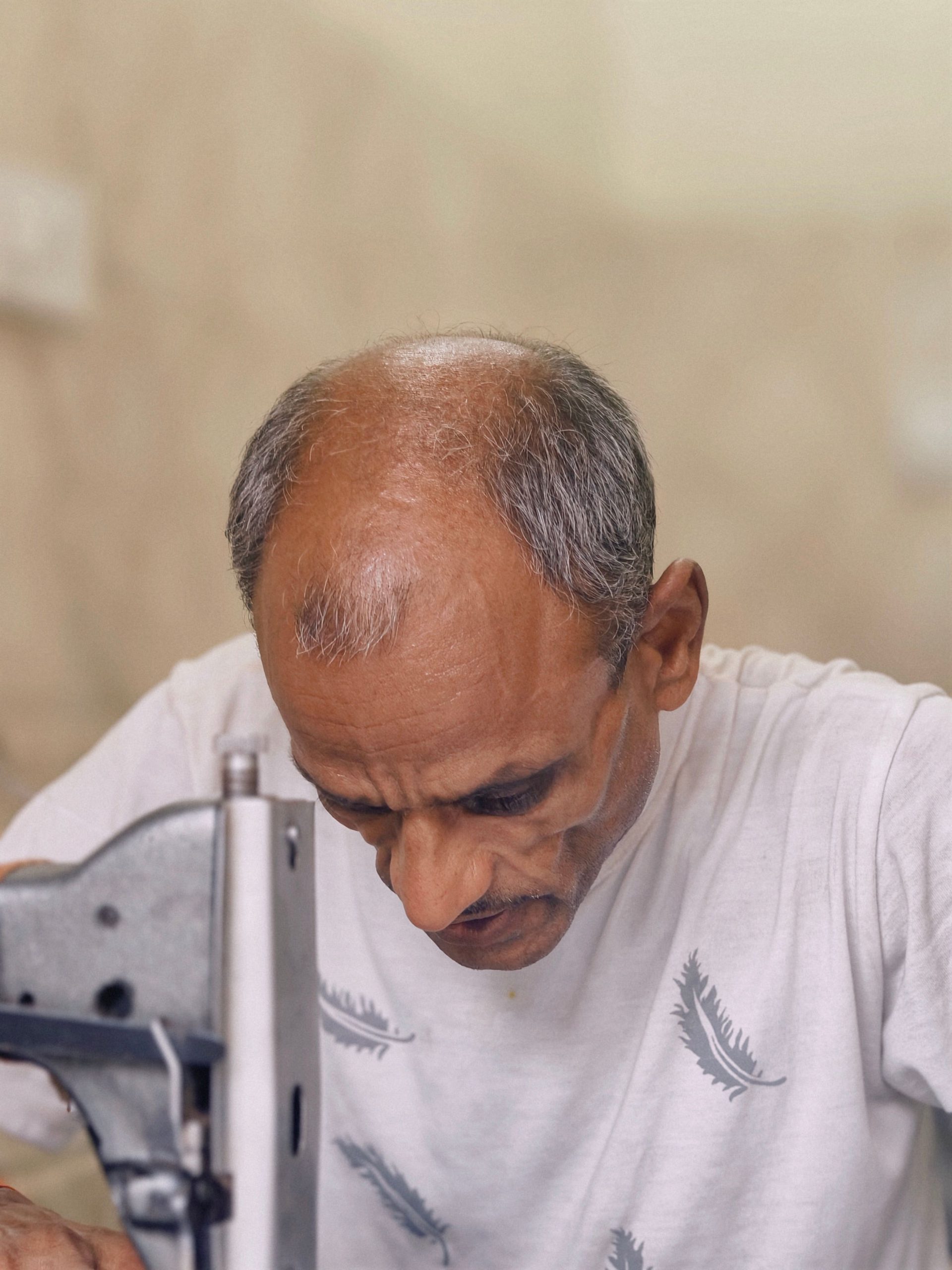 Début de calvitie : comment arrêter la chute ? 2 A tailor working intently on a sewing machine indoors, showcasing concentration and dedication. Un tailleur travaillant intensément sur une machine à coudre à l'intérieur, montrant concentration et dévouement.