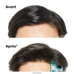 L’Oréal Professionnel Scalp Advanced purifiant AHA 3 %, vue 3