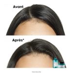 L’Oréal Professionnel Scalp Advanced purifiant AHA 3 %, vue 4